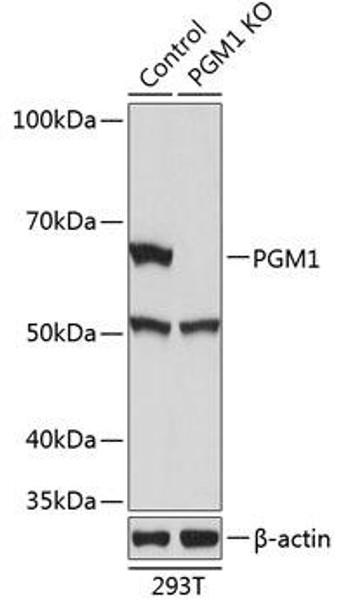 Anti-PGM1 Antibody (CAB19904)[KO Validated]