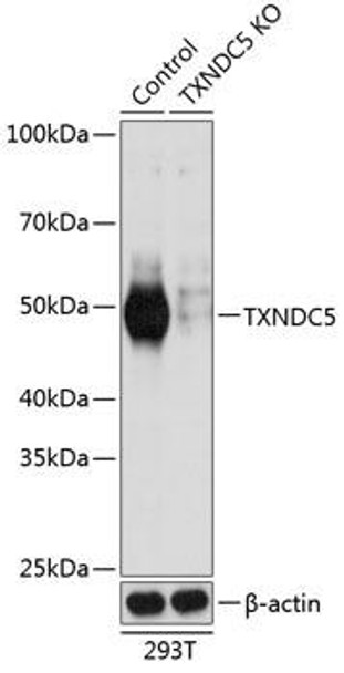 Anti-TXNDC5 Antibody (CAB19931)[KO Validated]