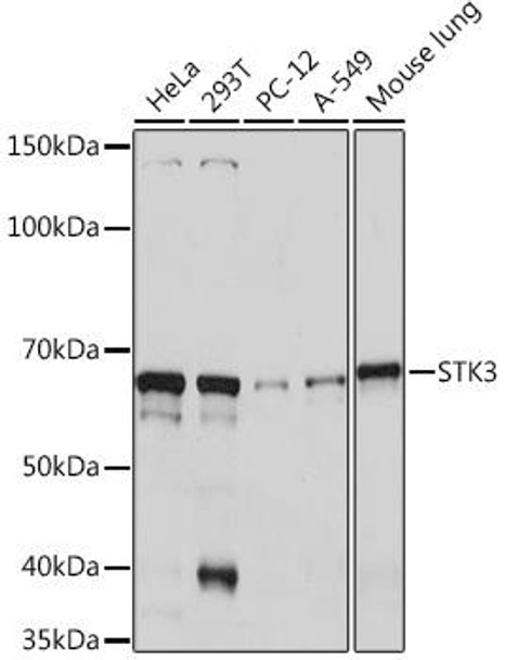 Anti-STK3 Antibody (CAB9036)