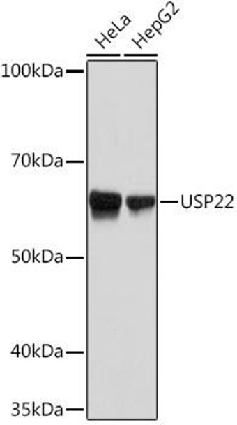 Anti-USP22 Antibody (CAB9261)