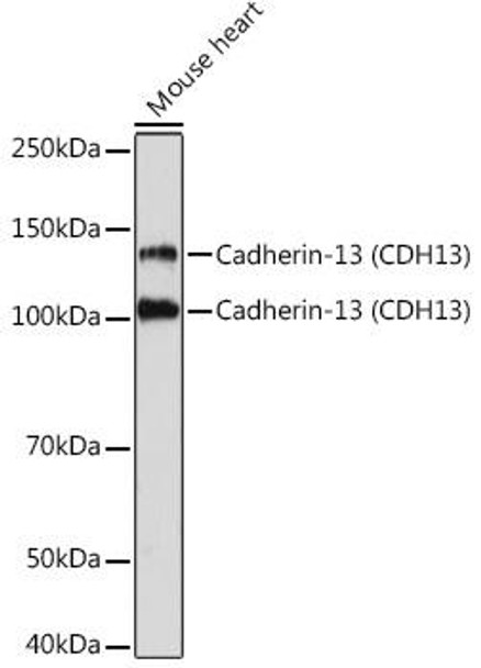 Anti-Cadherin-13 (CDH13) Antibody (CAB3244)