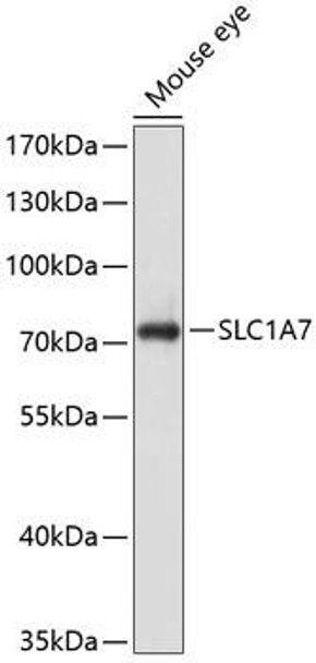 Anti-SLC1A7 Antibody (CAB10244)