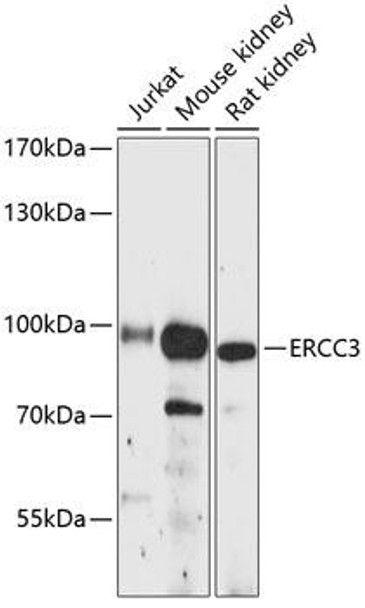 Anti-ERCC3 Antibody (CAB12702)