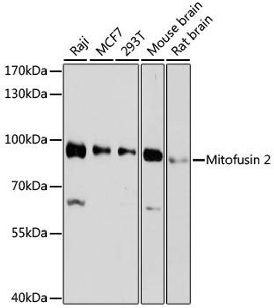 Anti-Mitofusin 2 Antibody (CAB12771)