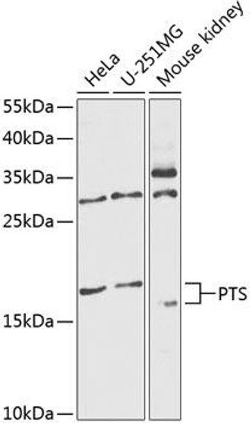 Anti-PTS Antibody (CAB14055)