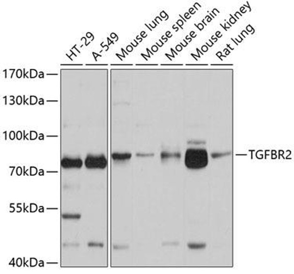 Anti-TGFBR2 Antibody (CAB1415)