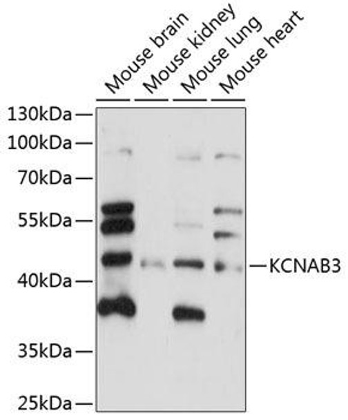 Anti-KCNAB3 Antibody (CAB14821)