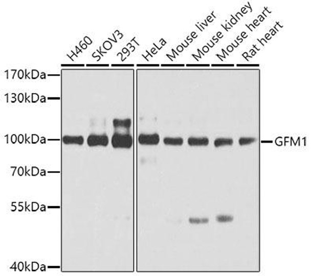 Anti-GFM1 Antibody (CAB5077)