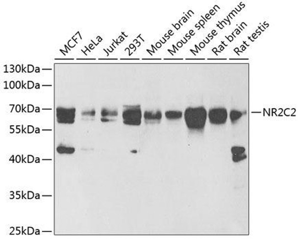 Anti-NR2C2 Antibody (CAB6422)