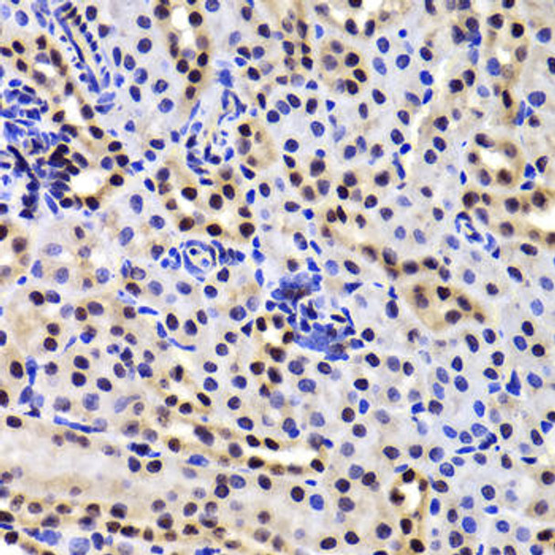 Anti-GABPB1 Antibody (CAB6909)