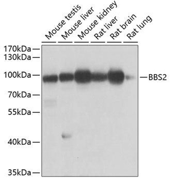 Anti-BBS2 Antibody (CAB7425)