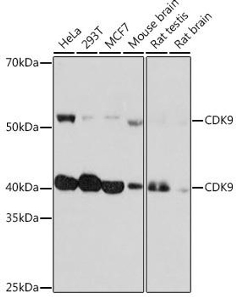 Anti-CDK9 Antibody (CAB11145)