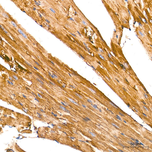 Immunohistochemistry analysis of paraffin-embedded Mouse heart tissue using β-Actin Mouse mAb (CABC004) at a dilution of 1:6000 (40x lens). High pressure antigen retrieval performed with 0.01M Tris-EDTA Buffer (pH 9.0) prior to IHC staining.