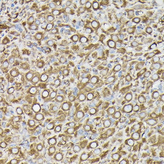Immunohistochemistry analysis of paraffin-embedded Rat ovary using β-Tubulin Mouse mAb (CABC021) at dilution of 1:100 (40x lens). High pressure antigen retrieval performed with 0.01M Citrate buffer (pH 6.0) prior to IHC staining.