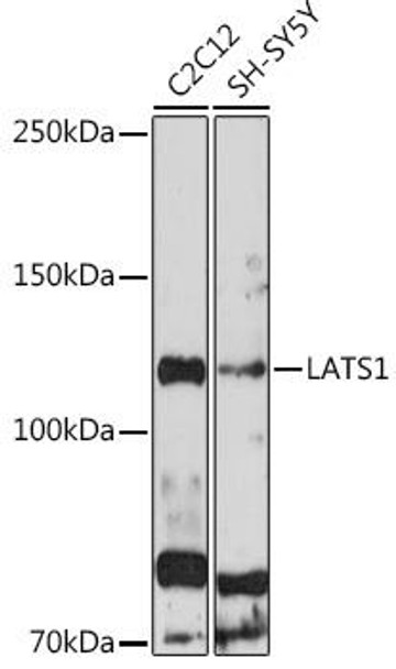Anti-LATS1 Antibody (CAB17992)