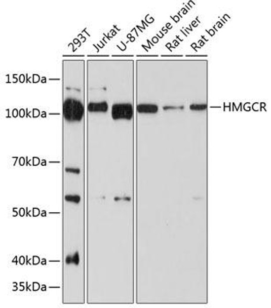 Anti-HMGCR Antibody (CAB19063)