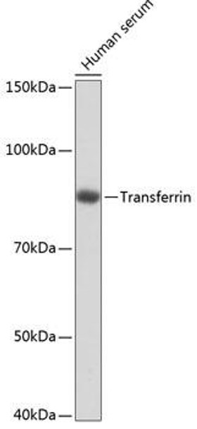 Anti-Transferrin Antibody (CAB19130)