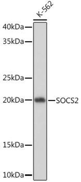 Anti-SOCS2 Antibody (CAB9190)