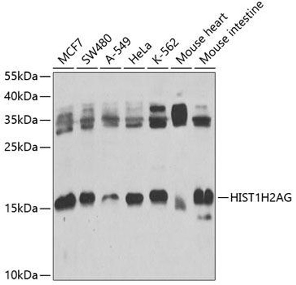 Anti-Histone H2A.1 Antibody (CAB9895)