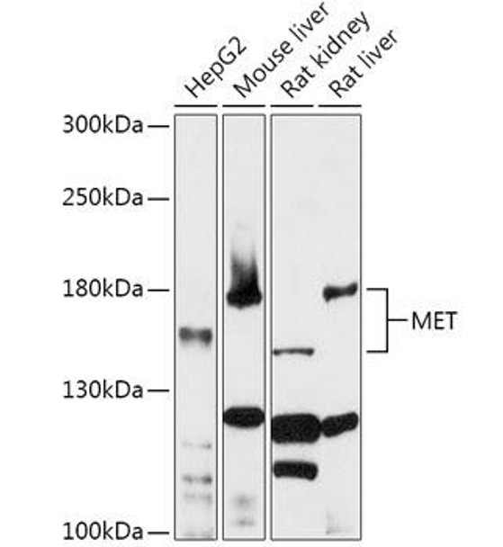 Anti-MET Antibody (CAB0040)