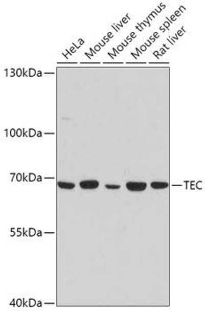 Anti-TEC Antibody (CAB0189)