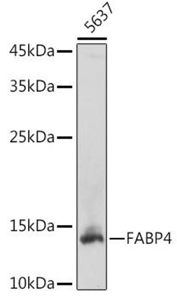 Anti-FABP4 Antibody (CAB0232)