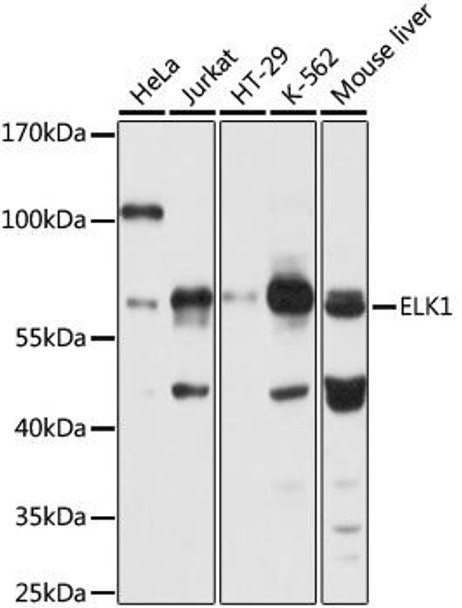 Anti-ELK1 Antibody (CAB0789)