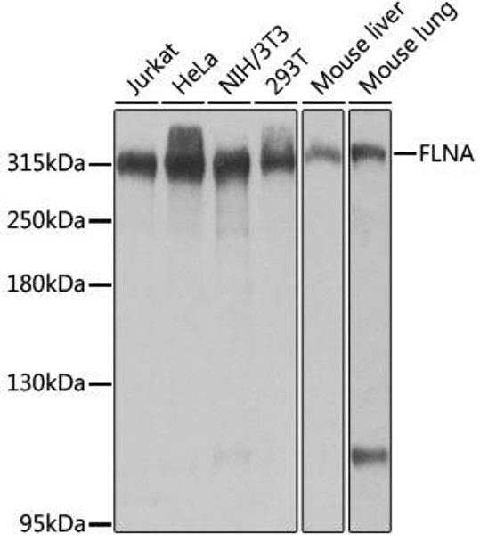 Anti-FLNA Antibody (CAB0927)