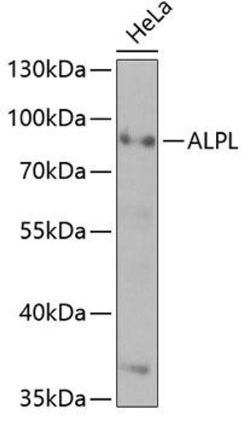 Anti-ALPL Antibody (CAB1080)