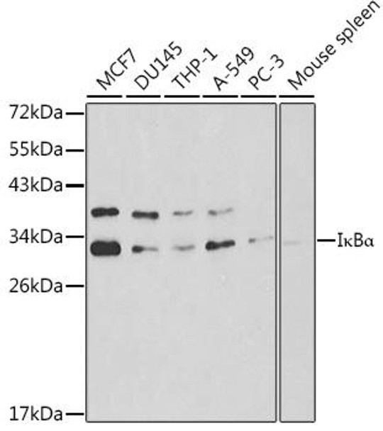 Anti-IkBAlpha Antibody (CAB11165)