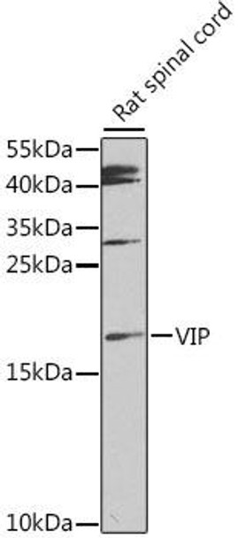 Anti-VIP Antibody (CAB12531)