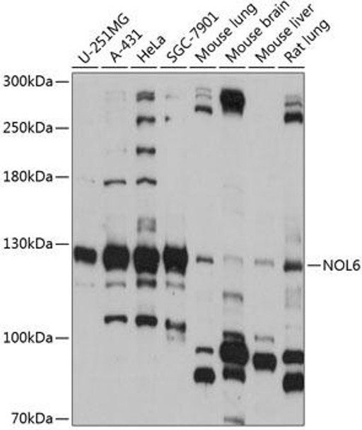 Anti-NOL6 Antibody (CAB14420)