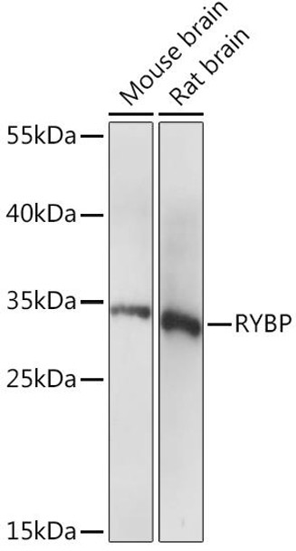 Anti-RYBP Antibody (CAB14605)