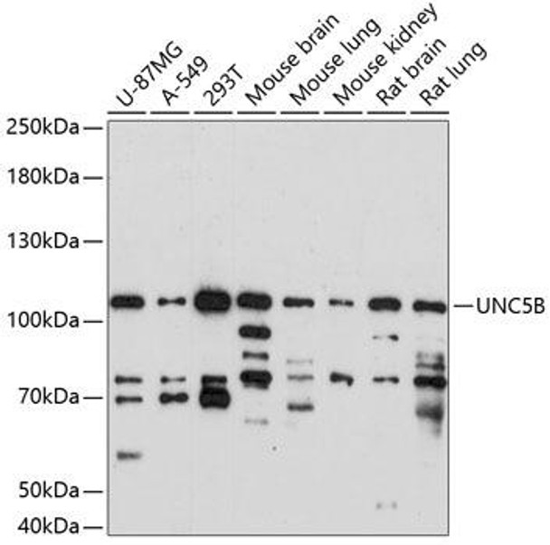 Anti-UNC5B Antibody (CAB14978)
