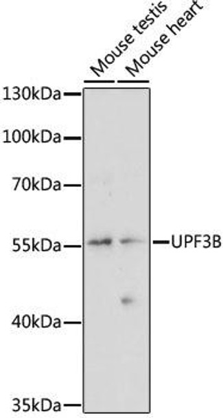 Anti-UPF3B Antibody (CAB15184)