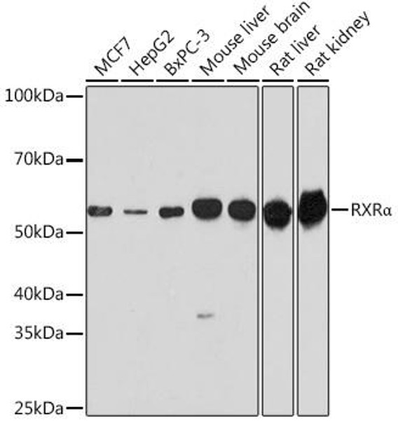 Anti-RXRAlpha Antibody (CAB15242)