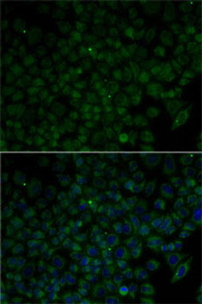 Anti-ANG Antibody (CAB1546)