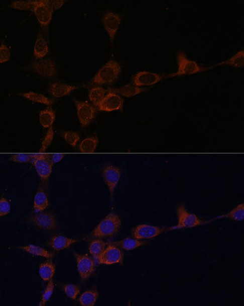 Anti-PIK3R4 Antibody (CAB15828)