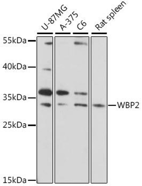 Anti-WBP2 Antibody (CAB16312)