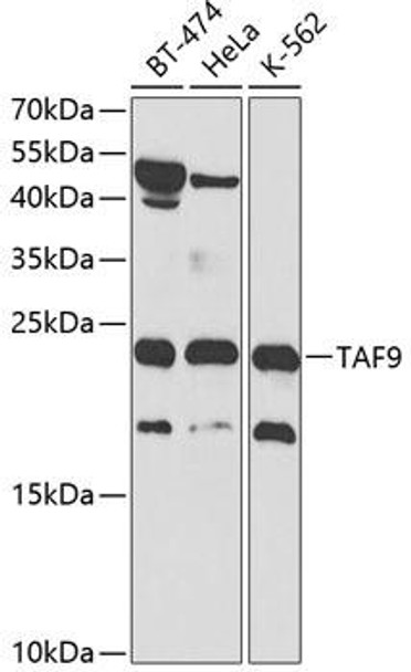 Anti-TAF9 Antibody (CAB2021)