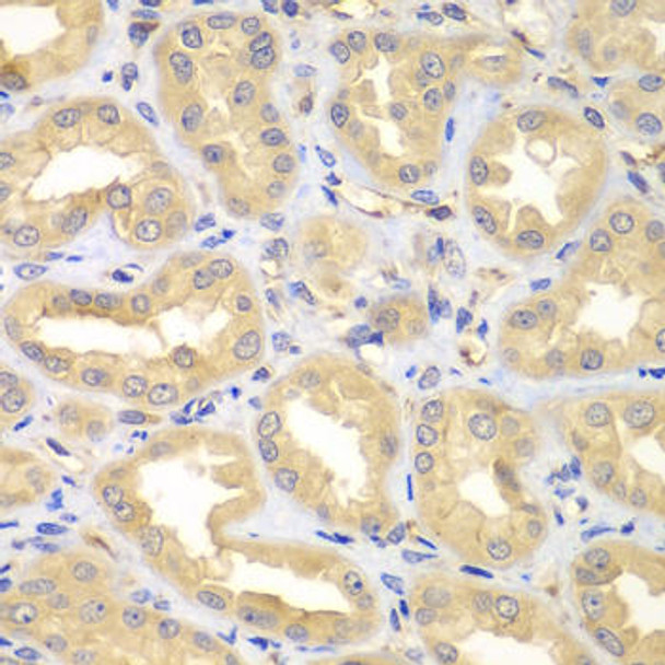 Anti-ELMO3 Antibody (CAB7182)