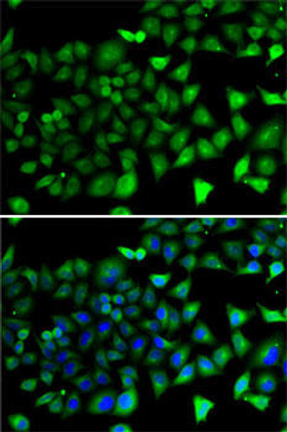 Anti-NFYB Antibody (CAB7295)