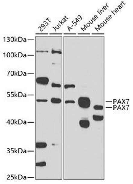 Anti-PAX7 Antibody (CAB7335)