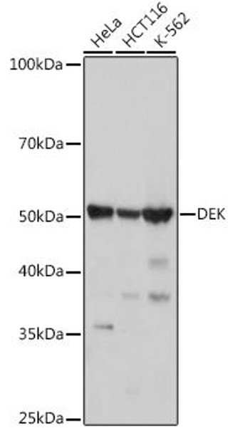 Anti-DEK Antibody (CAB0315)