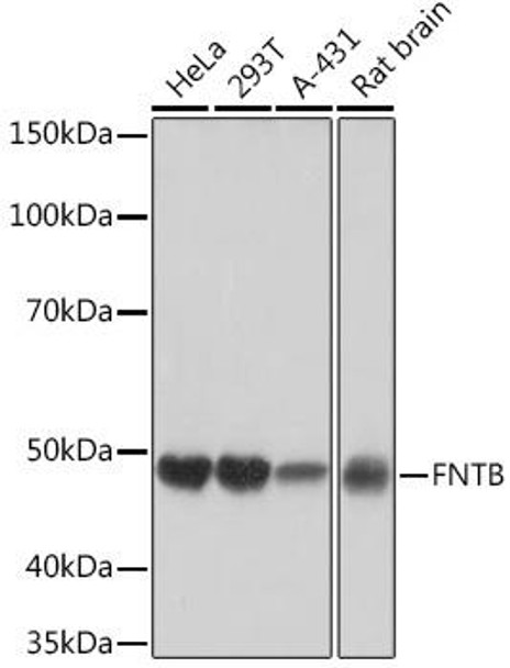 Anti-FNTB Antibody (CAB2611)