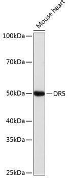Anti-DR5/TRAILR2/TNFRSF10B Monoclonal Antibody (CAB19043)