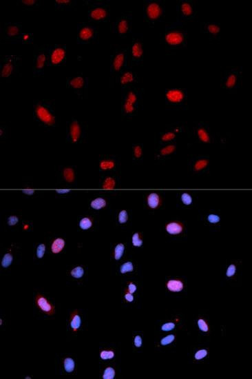 Anti-Phospho-MAP2K6-S207/MAP2K3-S189 Antibody (CABP0081)