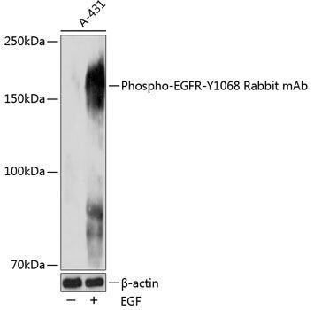 Anti-Phospho-EGFR-Y1068 [ARC0013] Monoclonal Antibody (CABP0027)