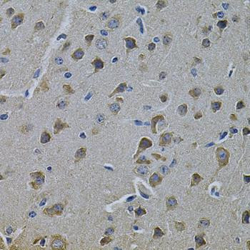 Anti-ErbB3/HER3 Antibody (CAB13976)