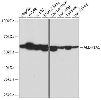 Anti-ALDH1A1 [ARC52440] Monoclonal Antibody (CAB0157)